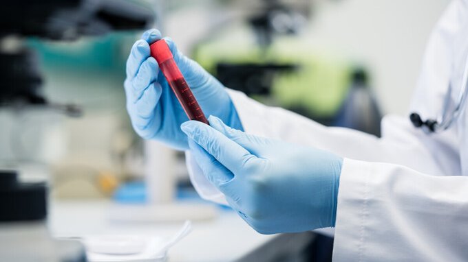 Vaccino dengue Italia: prezzo, dove farlo e chi lo può fare