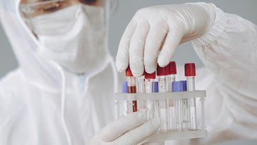Coronavirus scoperto nel 2013 e nascosto per 7 anni, rivela un'inchiesta esclusiva