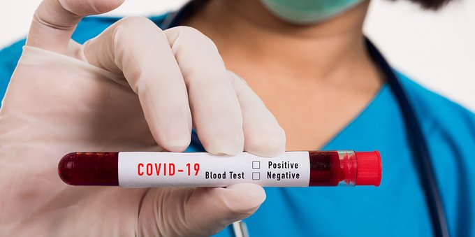 Tamponi contaminati: tracce di coronavirus nei kit, la scoperta shock