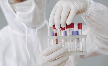 Virus Shamonda, cos'è? Sintomi, trasmissione e rischi concreti