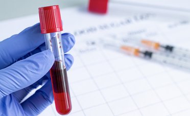 Come sapere il proprio gruppo sanguigno (anche senza analisi)