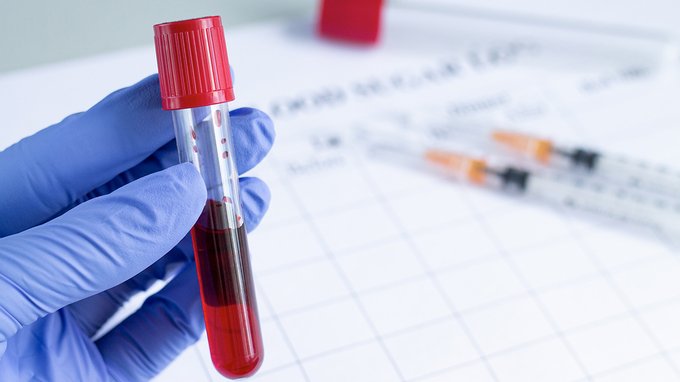 Scoperto un nuovo gruppo sanguigno: cosa cambia e perché è importante per gravidanze e malattie