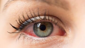 Collirio ritirato dall'AIFA: gravi rischi, viene utilizzato anche dai bambini