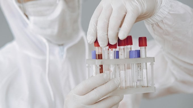 Virus Shamonda, cos'è? Sintomi, trasmissione e rischi concreti