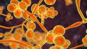 Candida auris, come si prende e rischi in caso di contagio del fungo killer