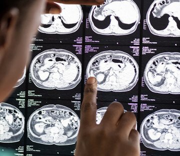 Se fai queste 5 attività, hai un cervello migliore della maggior parte delle persone. Parla un esperto di neuroscienze