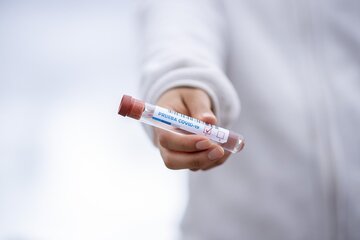 Covid, torna il tampone obbligatorio: ecco dove e chi deve farlo