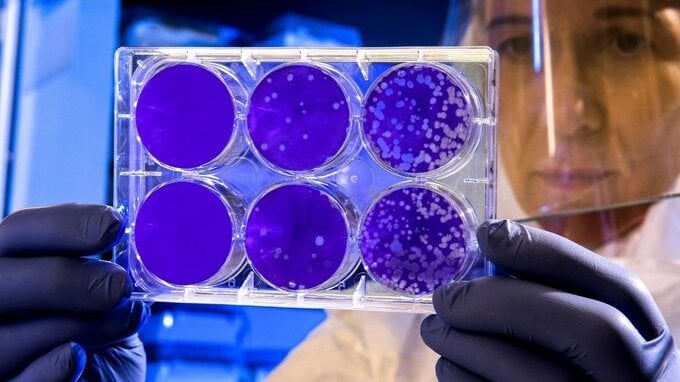 Ci saranno delle nuove varianti oltre alla Delta: i possibili scenari del futuro