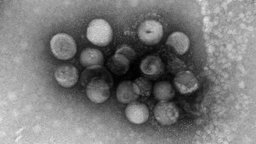 Due nuovi coronavirus potrebbero infettare l'uomo: vengono dai cani