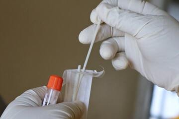 Covid: guida al rimborso per tamponi antigenici e test fai da te