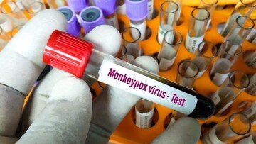 Vaiolo delle scimmie, il virus è nel liquido seminale: «Attenzione ai rapporti sessuali». Come evitare il contagio