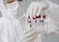 Virus Shamonda, cos'è? Sintomi, trasmissione e rischi concreti