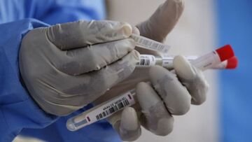 Chi farà il test di immunità in Italia: il bando con le istruzioni