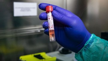 Test coronavirus fai da te e veloci in arrivo grazie a Bill Gates e Alibaba