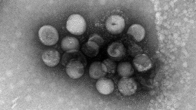 Due nuovi coronavirus potrebbero infettare l'uomo: vengono dai cani
