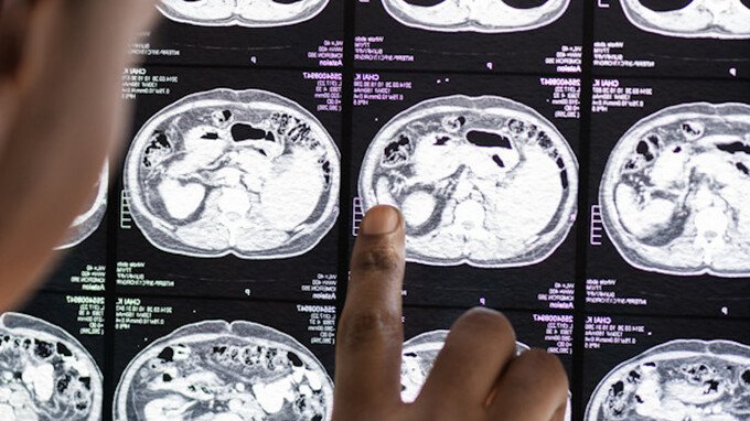 Se fai queste 5 attività, hai un cervello migliore della maggior parte delle persone. Parla un esperto di neuroscienze