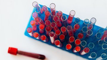Prelievi del sangue senza aghi: la promessa arriva dall'America