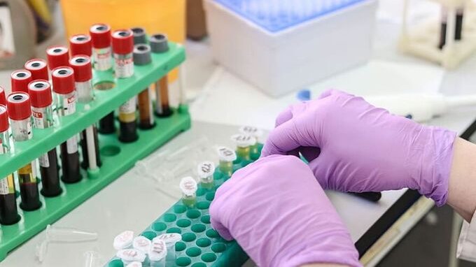 Quanto siamo vicini alla fine degli esami del sangue con gli aghi?