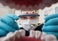 Bonus dentista 2025, ecco a chi spettano sconti per la cura dei denti