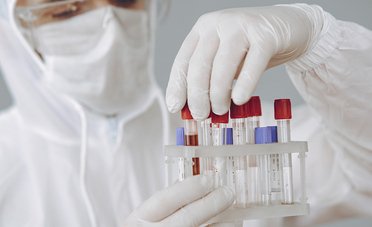 Cos'è l'indice Rt, la misura che ci dice se arriverà un altro lockdown