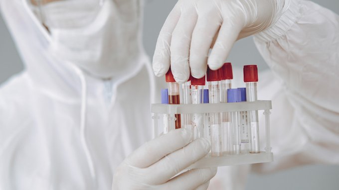 Il vaccino a mRNA non convince la Cina: possibili rischi per la salute