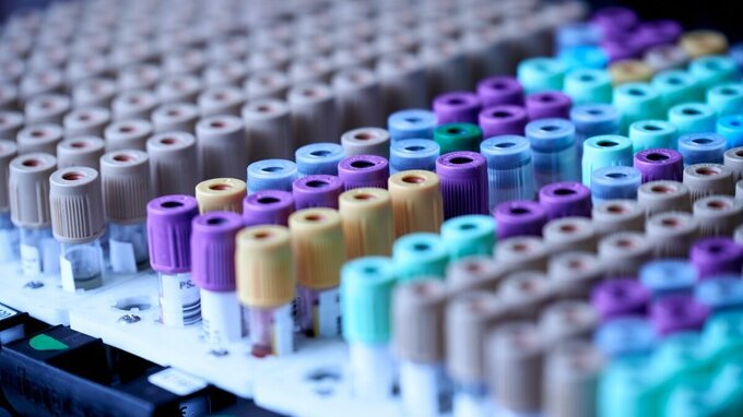 Test sierologico: quanto costa e dove farlo