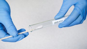 Diasorin protagonista: ok al test rapido sul coronavirus. Cosa cambia?
