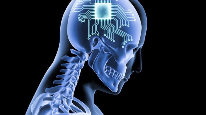 Neuralink Elon Musk, cos'è e a cosa serve il chip Telepathy