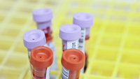 Coronavirus: i test di immunità potrebbero sostituire il vaccino?