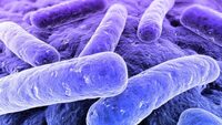 Legionella in Sicilia, muore una donna: aperta indagine epidemiologica sull'origine