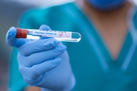 Anticorpi del Covid diminuiscono dopo infezione: lo studio choc