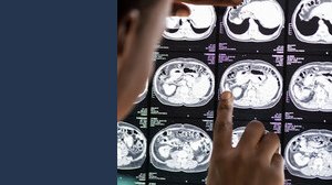 Se fai queste 5 attività, hai un cervello migliore della maggior parte delle persone. Parla un esperto di neuroscienze
