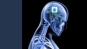 Neuralink, Elon Musk vuole avviare i test clinici dei chip sull'uomo