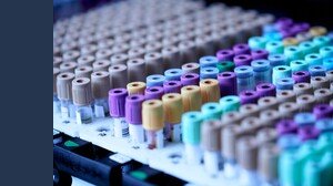 Coronavirus, 1,4 milioni di italiani hanno gli anticorpi, record in una città: ecco quale
