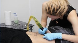 Rimozione del tatuaggio, quanto costa: tempi e tariffe