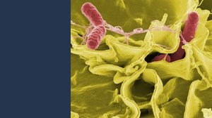Allerta salmonella negli USA: i pericoli per l'uomo