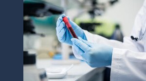 Vaccino dengue Italia: prezzo, dove farlo e chi lo può fare