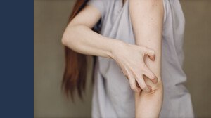 Allarme scabbia Roma: sintomi e cosa fare in caso di contagio