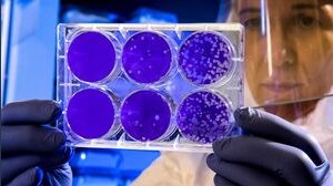 Ci saranno delle nuove varianti oltre alla Delta: i possibili scenari del futuro