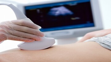  Diritto all'aborto, come funziona in Italia