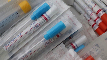 Coronavirus, arriva il tampone privato a 100 euro: è boom di richieste