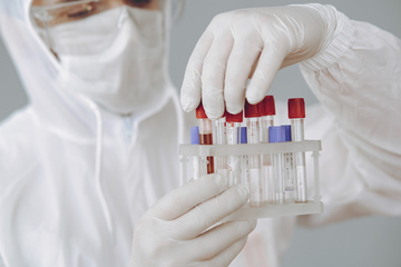 Il vaccino a mRNA non convince la Cina: possibili rischi per la salute