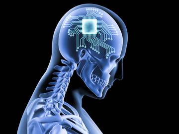 Bill Gates investe in Synchron, rivale di Neuralink